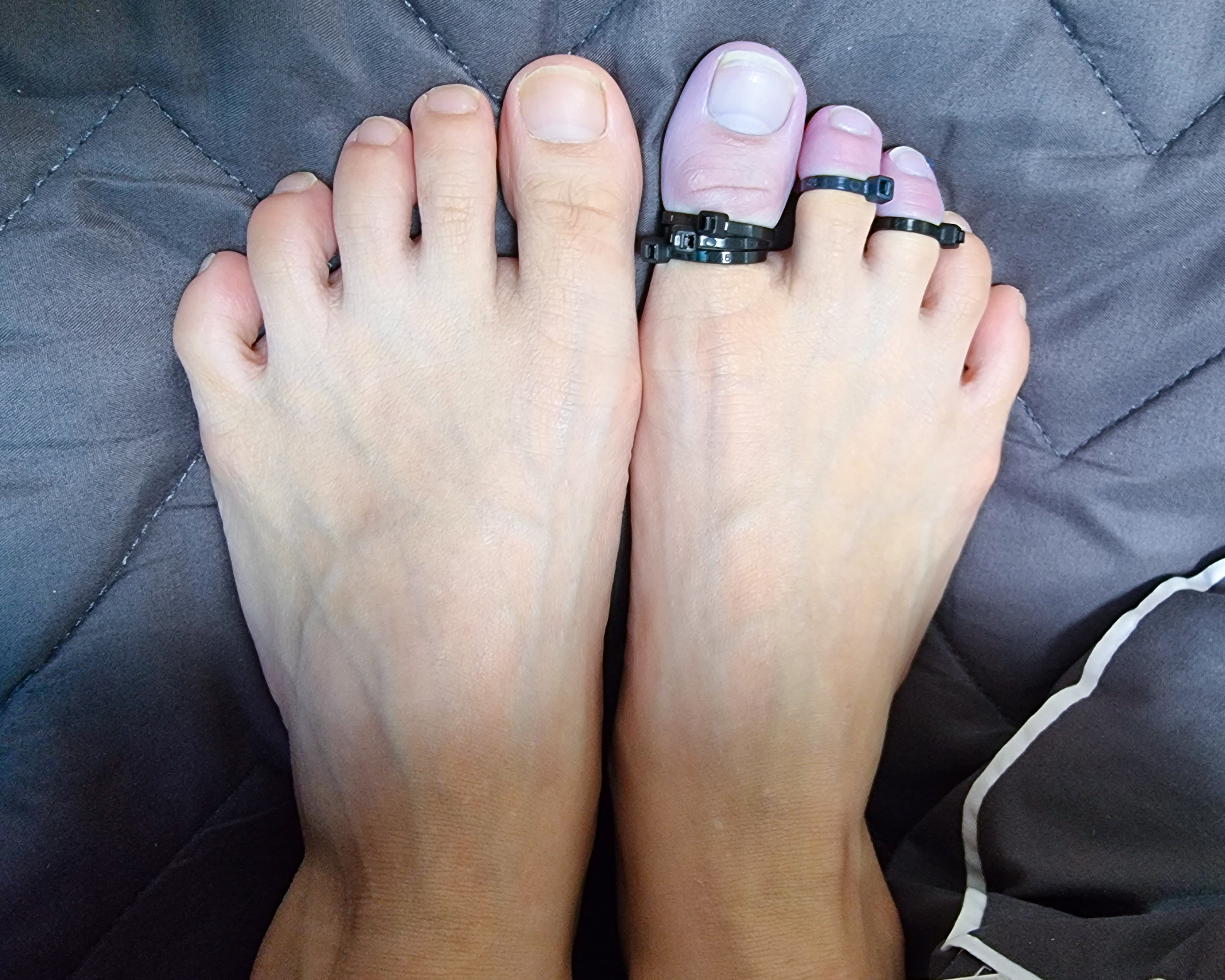 Beautiful Tied Up Toes — 10